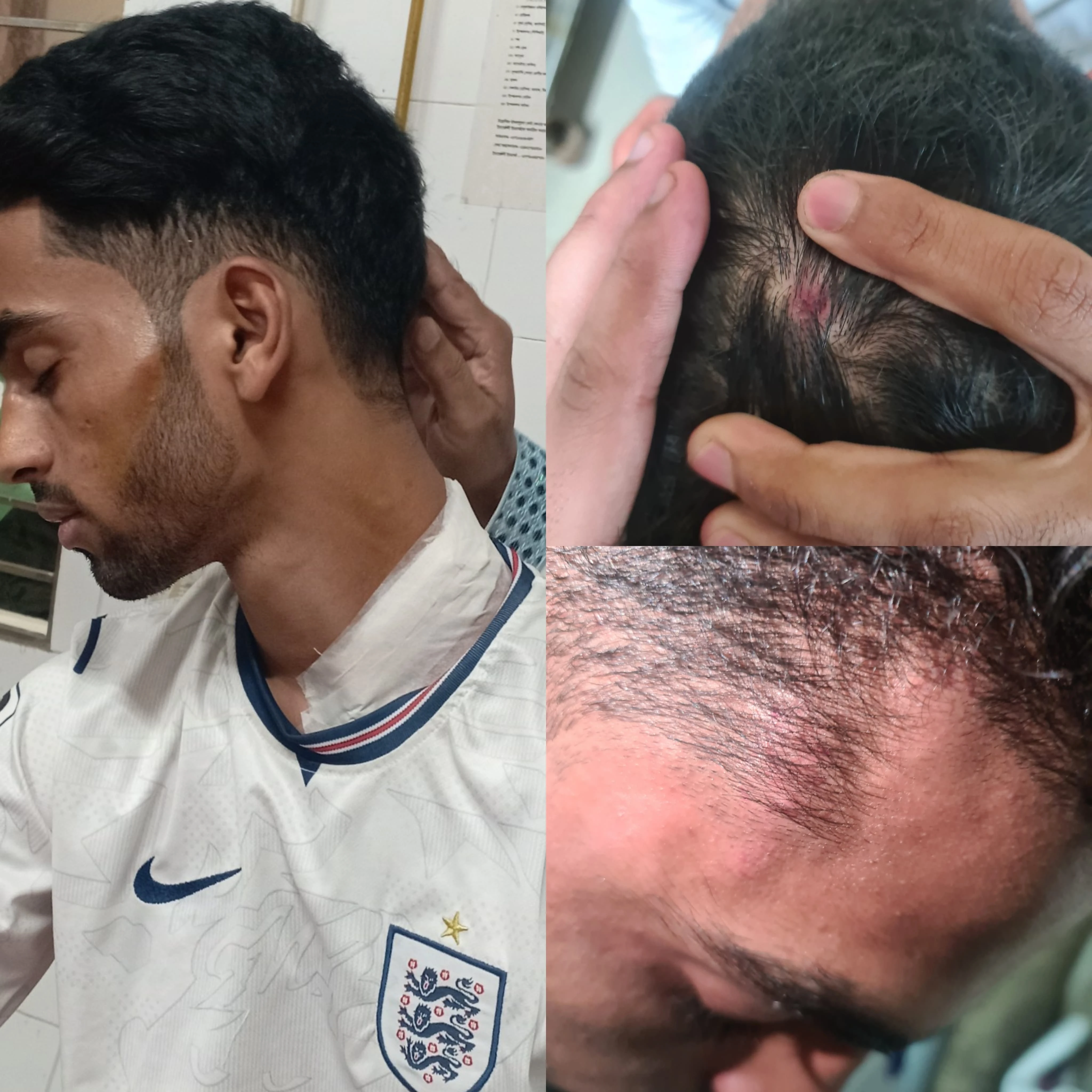 সুনামগঞ্জে নামাজে যাওয়ার পথে ছাত্রশক্তি নেতার ওপর বিএনপির হামলা