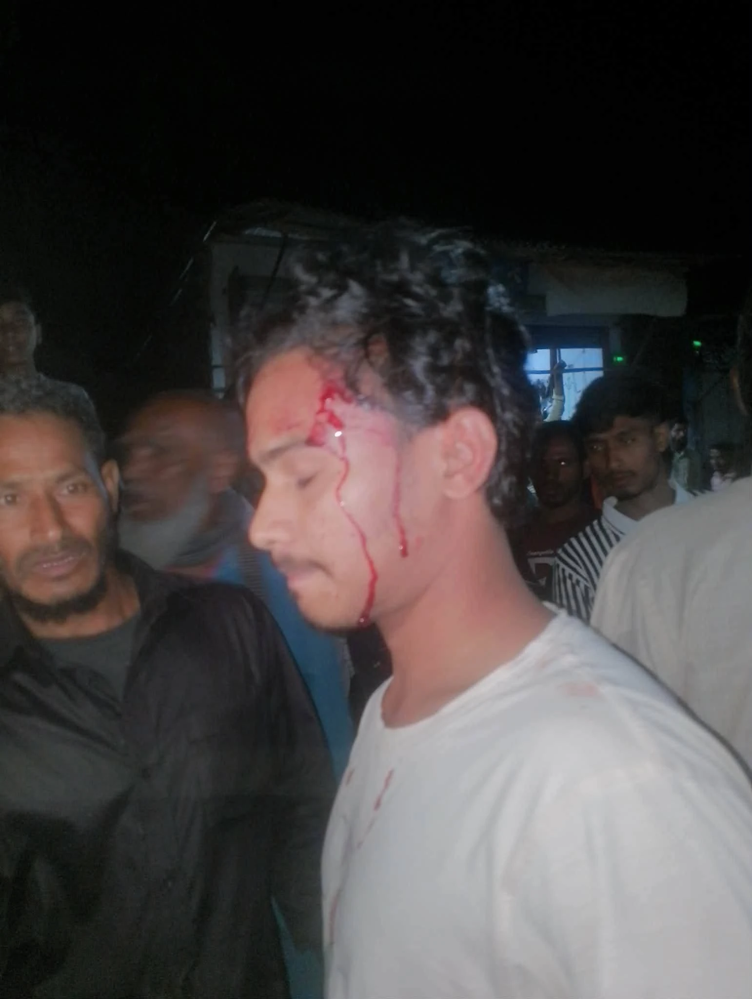 দাওয়াত দিয়ে ডেকে নিয়ে হামলা, উত্তেজনা পাটগ্রামে