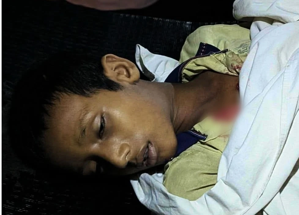 আম খাওয়াকে কেন্দ্র করে বন্ধুর ছুরিকাঘাতে প্রাণ গেল কিশোরের