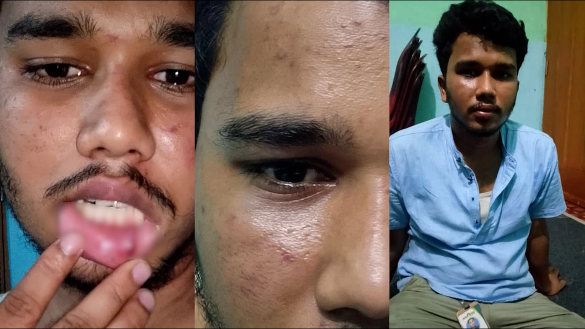 রায়পুরে সংবাদ সংগ্রহে গিয়ে হামলার শিকার সাংবাদিক